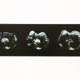 Dalia Mikonytė, „III stadijos“. I. Armanavičiūtės nuotr.