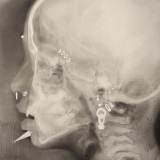 Iš ciklo „Atodangos“ (2012).